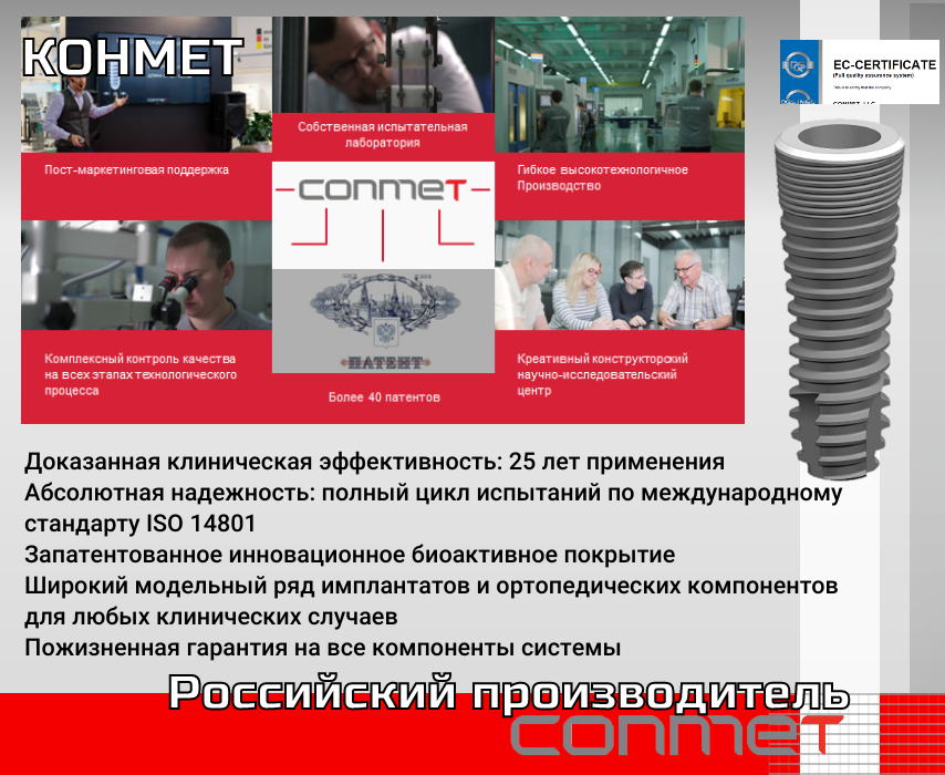 КОНМЕТ - российский производитель: дентальных имплантатов, ортодонтических имниимплантатов, изделий для челюстно-лицевой хирургии!